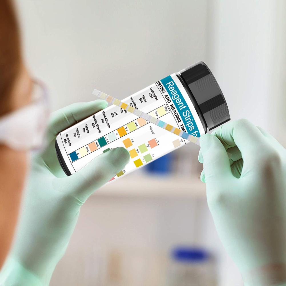 尿検査ストリップ,10個のパラメーター,尿検査,白化,亜塩素 - Urinalysis Reagent Strip のレビューと価格