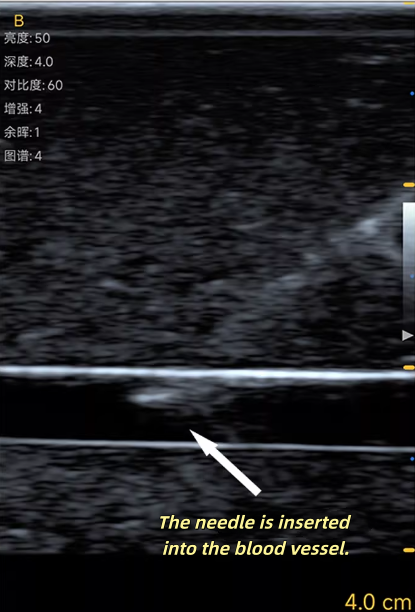 超音波血管穿刺トレーニングモデル ジェル自己修復素材 医療ト - Medical Gel Ultrasound のレビューと価格