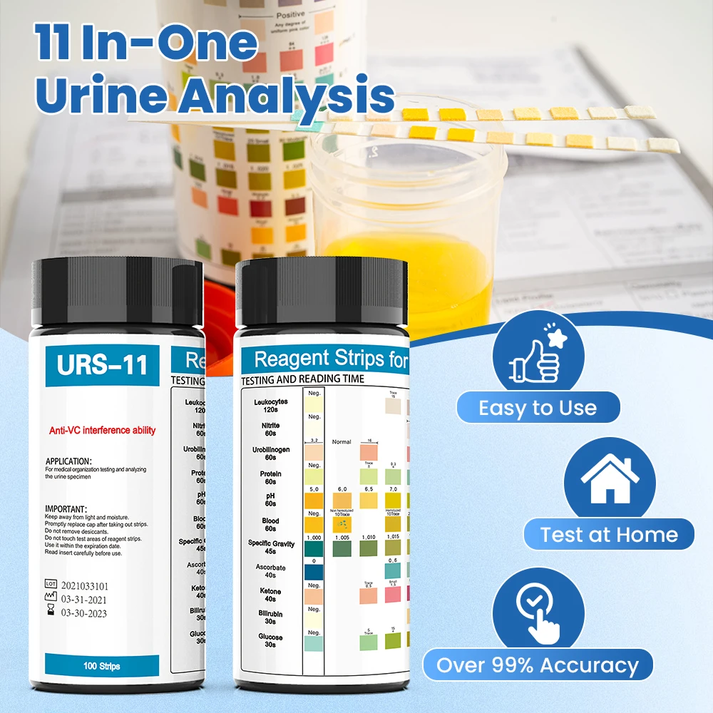 動物用尿検査ストリップ,W-200B/W-600/IU-10 - Urinalysis Reagent Strip のレビューと価格